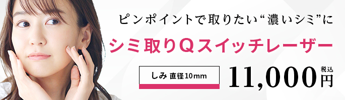 ピンポイントで取りたい濃いシミに シミ取り 直径10mm 11,000円(税込)